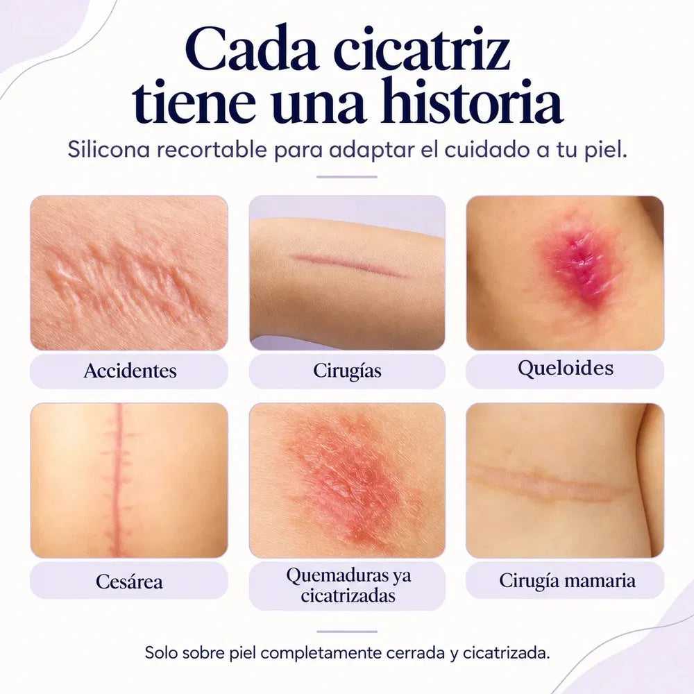 Tipos de cicatriz en los que se usa la cinta de silicona